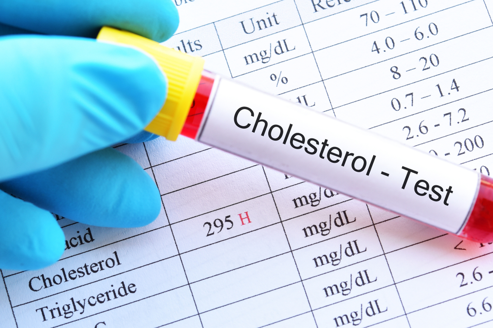 jangan buru-buru pakai simvastatin, berikut obat alami menurunkan kolesterol